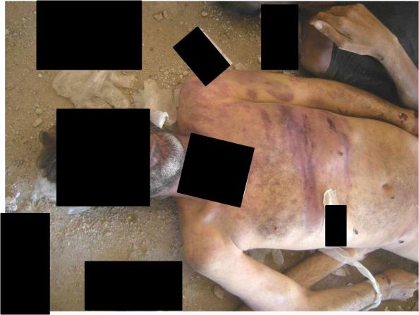 Heridas en cuerpos producidas supuestamente por golpes con "objetos como barras".