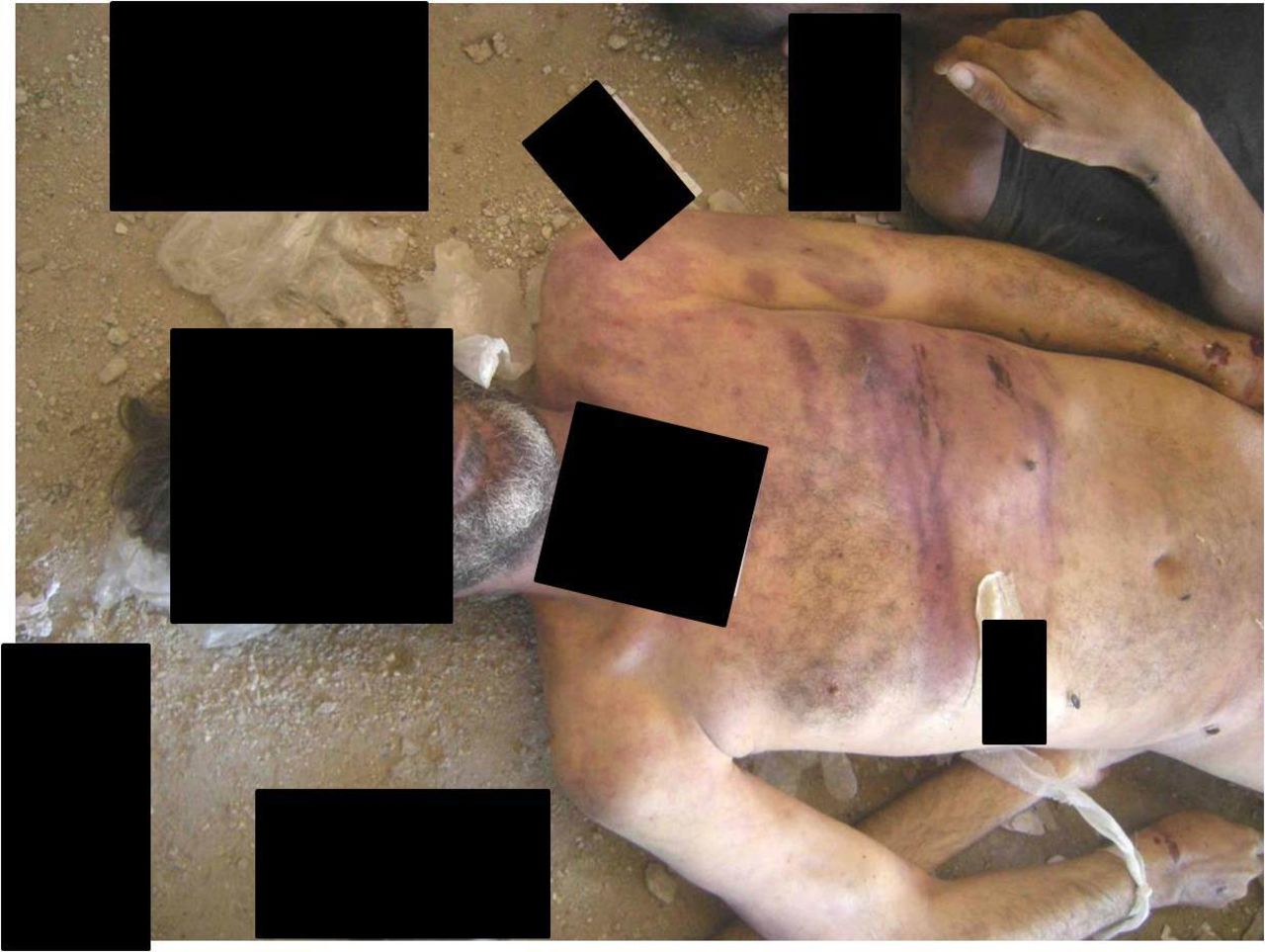 Injuries on corpses allegedly produced by blows with "rod-like objects."