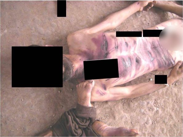 Heridas en el pecho y abdomen de un hombre que supuestamente murió en poder del gobierno sirio.<br />