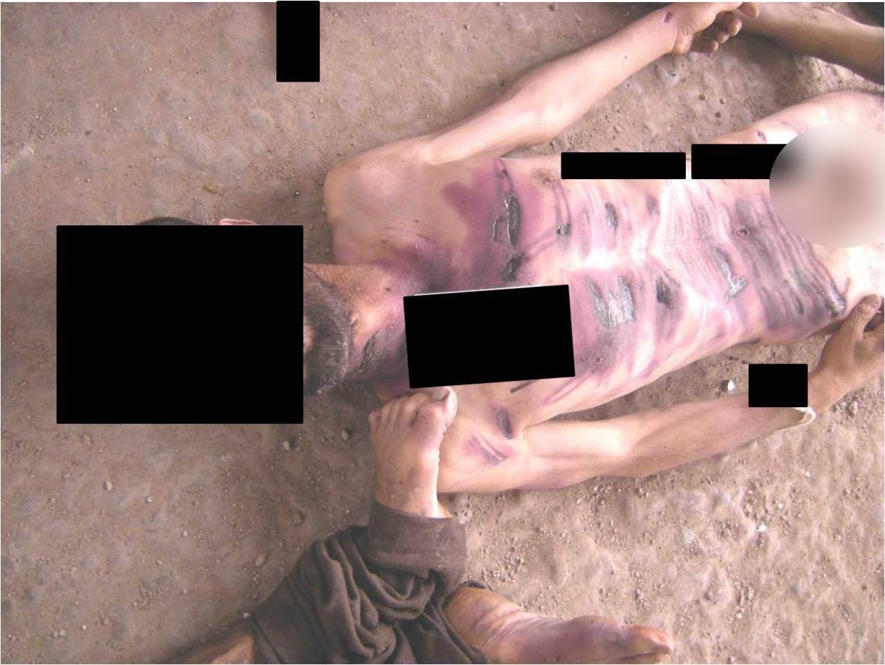 Wounds line the chest and abdomen of a man allegedly killed in Syrian government custody.