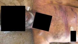 Syria War Torture Photos