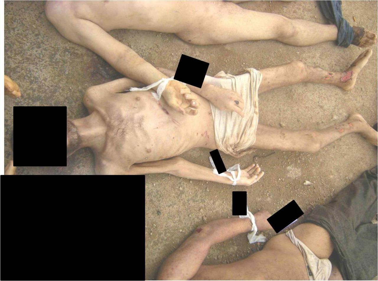 Un hombre muerto supuestamente bajo custodia del gobierno sirio muestra las heridas abiertas en las espinillas y tobillos.