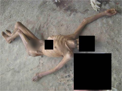In an image from a report by three renowned war crimes prosecutors, the emaciated remains of a man allegedly killed in Syrian custody are shown. CNN received the photos partially obscured to protect the identity of the source.