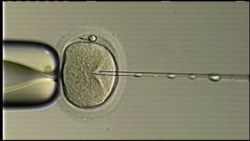 dnt sperm switch ferility clinic_00001405.jpg