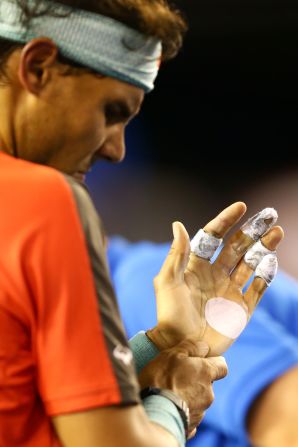 Nadal's victory was particularly impressive considering he had to contend with 17-time grand slam winner Federer and blisters on his left palm.