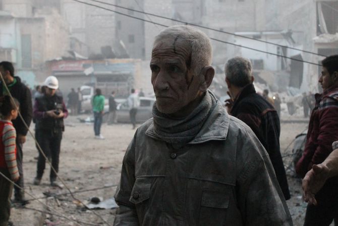 Un hombre herido está cubierto de polvo después de un ataque aéreo el 29 de enero. 