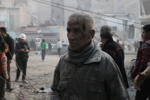 An injured man is covered in dust after an airstrike on January 29.