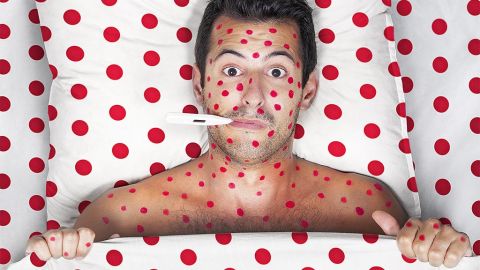 Sick man red spots