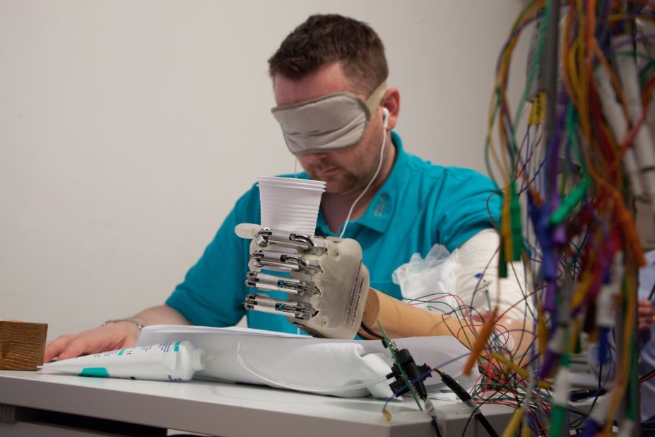 Dennis Aabo Sorensen wears an artificial hand enabled for sensory feedback. He is the first amputee to be able to feel objects with a special prosthetic device that communicates with his nervous system through electrodes in his arm. 