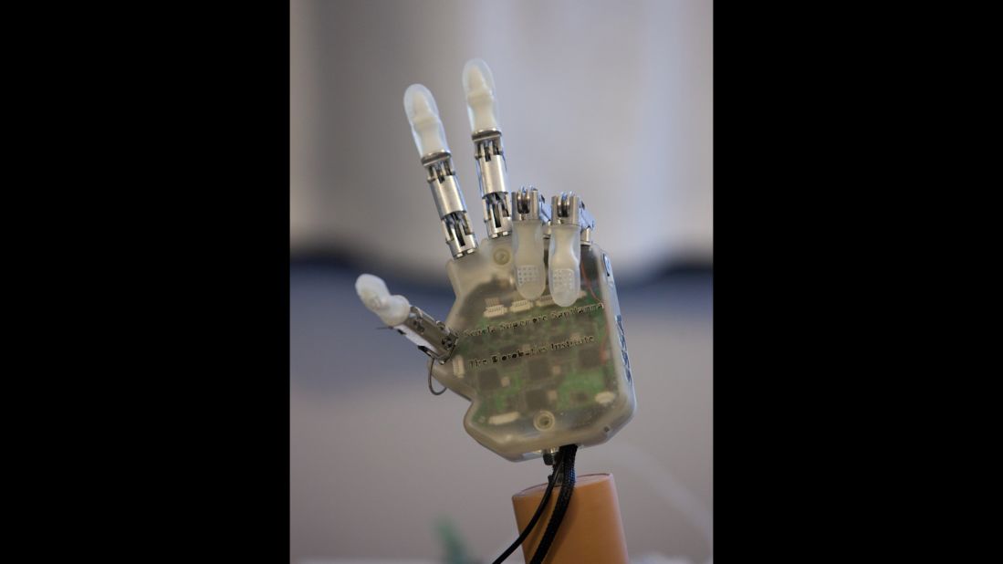 Sensors in the tendons of the artificial hand detect information about touch.