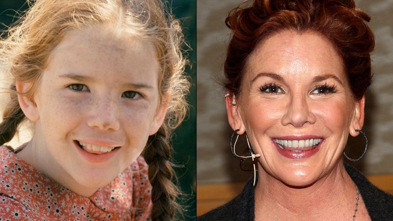 The Real Reason Mary Ingalls Went Blind CNN   140211103508 Restricted Melissa Gilbert 