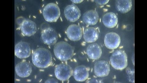 Nanomotors -- tiny gold rods -- interact with HeLa cells. 