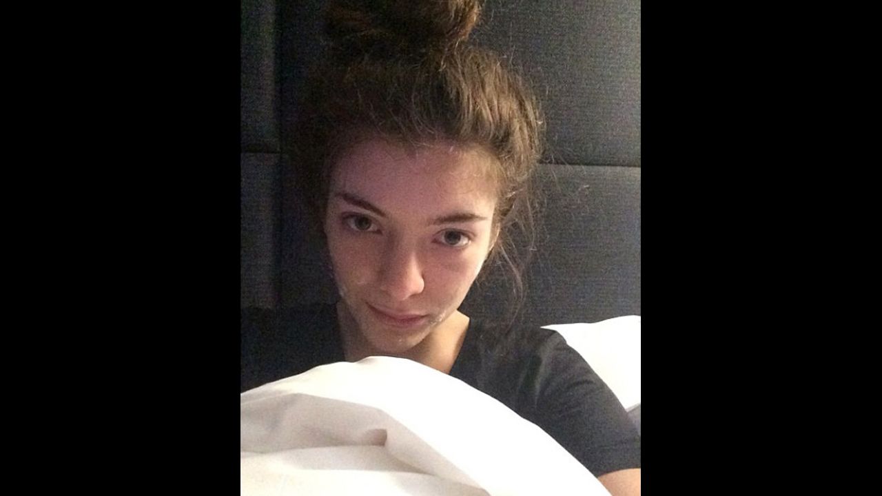 Singer Lorde posted a makeup-less selfie on her Instagram account in February 2014 with the caption "In bed in Paris with my acne cream on." 