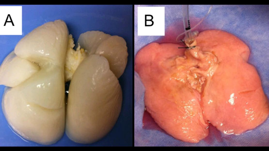 Image A is before new cells were reseeded. The finished product is image B.