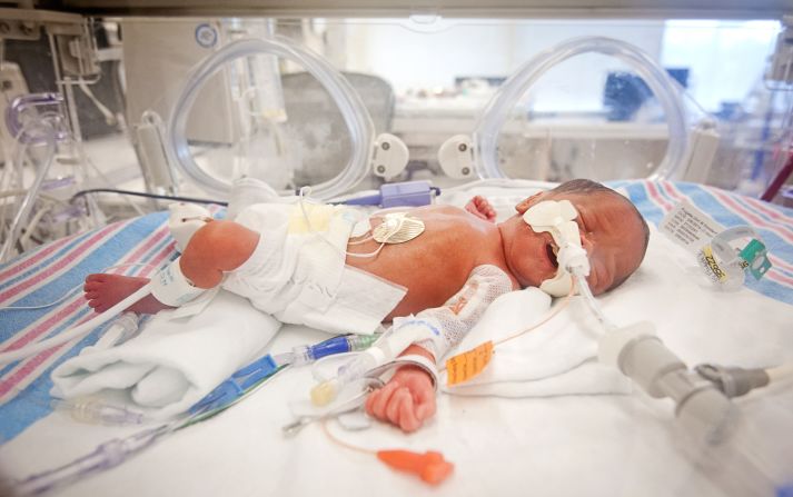 Despite being born 13 weeks premature, the babies are all doing well, the hospital says. 