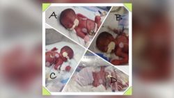 pkg woman gives birth to surprise quadruplets_00003121.jpg