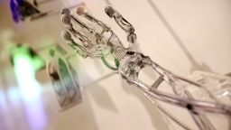 A 3D printed prosthetic arm is displayed in the Science Museum on October 8, 2013 in London, England.