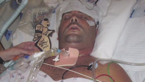 Bryan Stow spent nine months in a coma after he was severely beaten in an unprovoked attack in 2011.