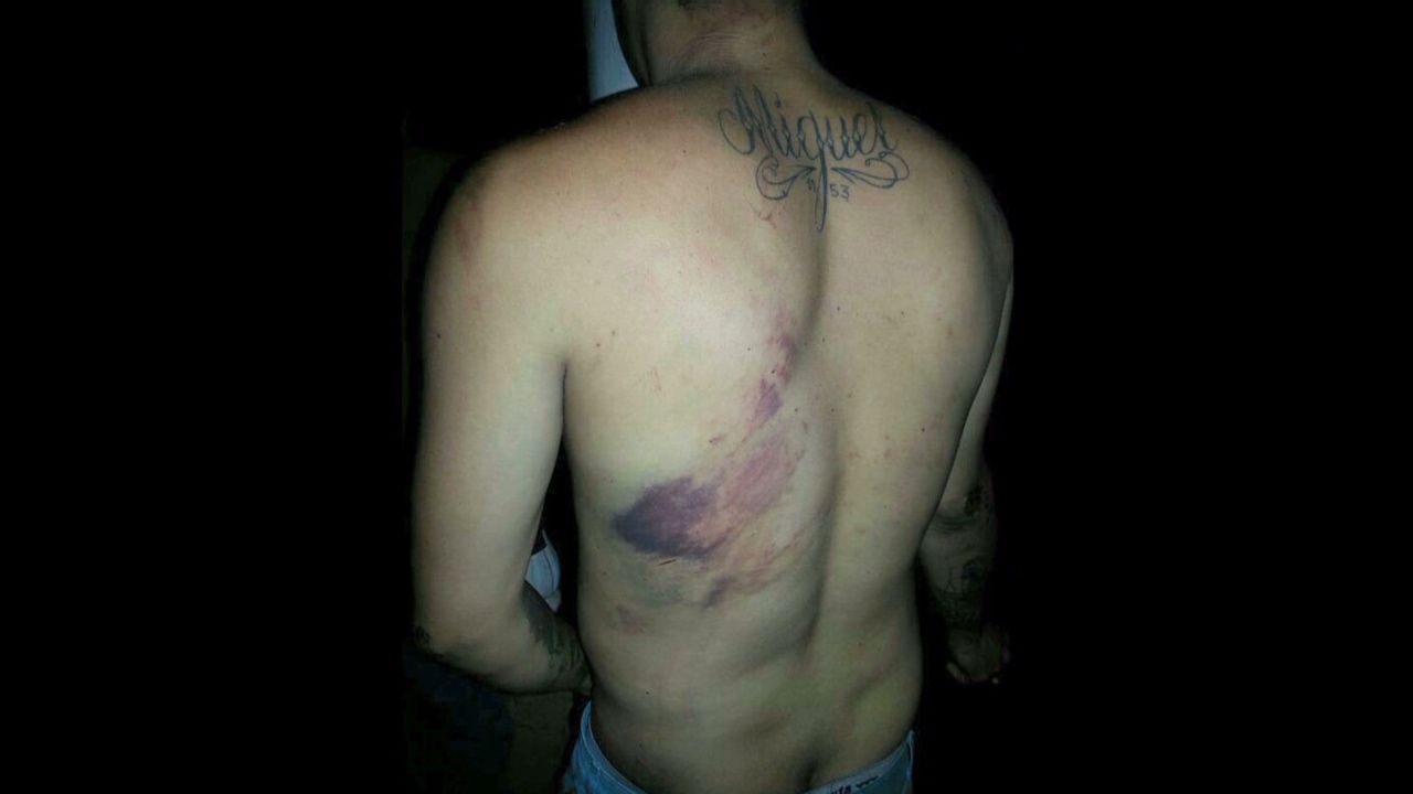 venezuela torture 