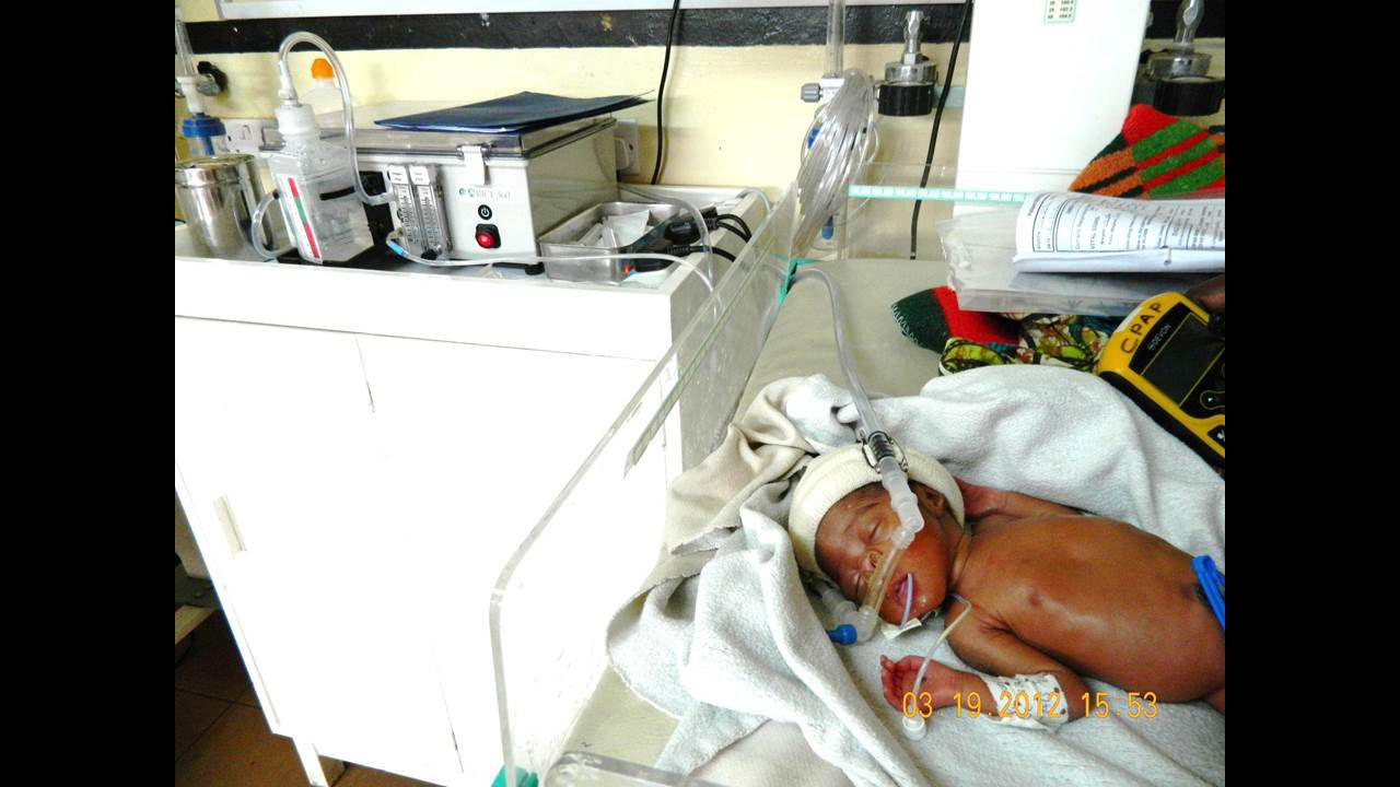 A newborn at Queen Elizabeth, the teaching hospital for the University of Malawi, is aided by the aquarium pump bubble CPAP machine.