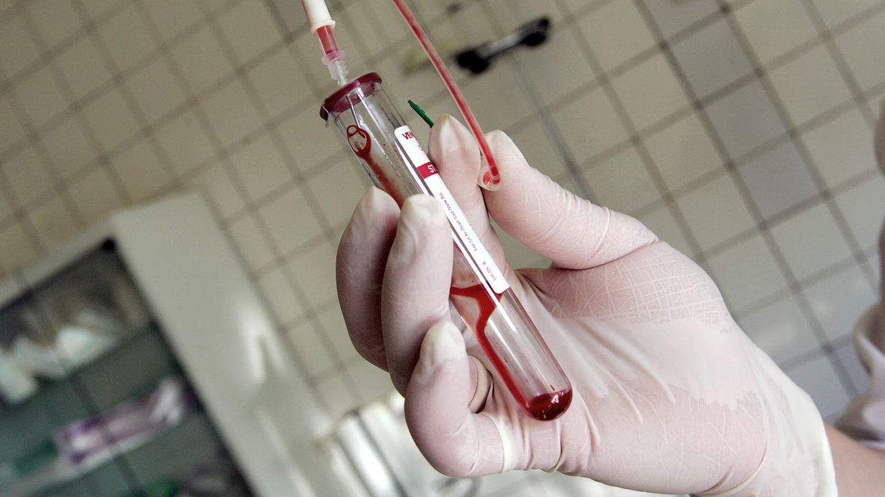 TO GO WITH AFP STORY ' Les enfants du sida, parias de la societe en Russie' (FILES) This file picture taken 19 June 2006 shows a nurse holding a test-tube with HIV positive blood in an infectious diseases hospital in Moscow. About 330,000 people in Russia carry the virus, 50,000 of them aged between 15 and 19, and more than 1,500 babies born to HIV-positive mothers are given up every year. AFP PHOTO / MAXIM MARMUR (Photo credit should read MAXIM MARMUR/AFP/Getty Images)