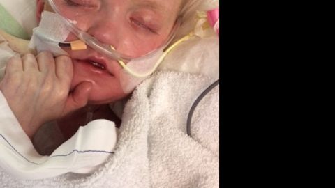 Josh Hardy was in critical condition last week.