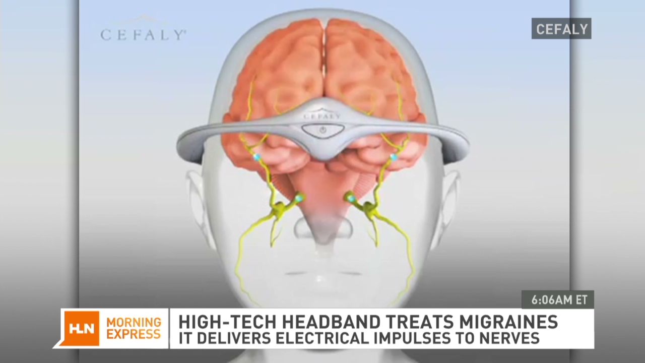 FDA approves first medical device for migraine prevention CNN