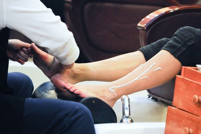 <strong>The lotion you've used forever</strong><br /><br />You've used it every day for the last 10 years, yet suddenly you're seeing red bumps whenever you apply your favorite cream. It happens, Zirwas says. If you're genetically susceptible to be allergic to a certain chemical, you're playing the lottery every time you use a product that contains it. <br /><br />"You can use something for years and years and years with no problem at all," he says. But "once you're allergic to it, you'll stay allergic your whole life."