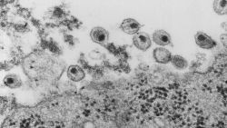 Human immunodeficiency virus (HIV), co-cultivated with human lymphocytes.