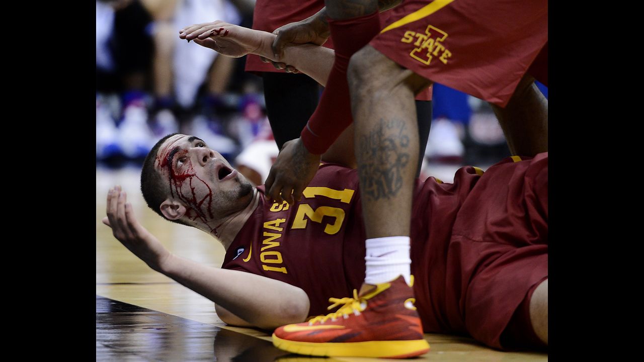 Iowa State's Georges Niang lies on the court bleeding after taking a charge against Kansas in the semifinals of the Big 12 basketball tournament Friday, March 14.