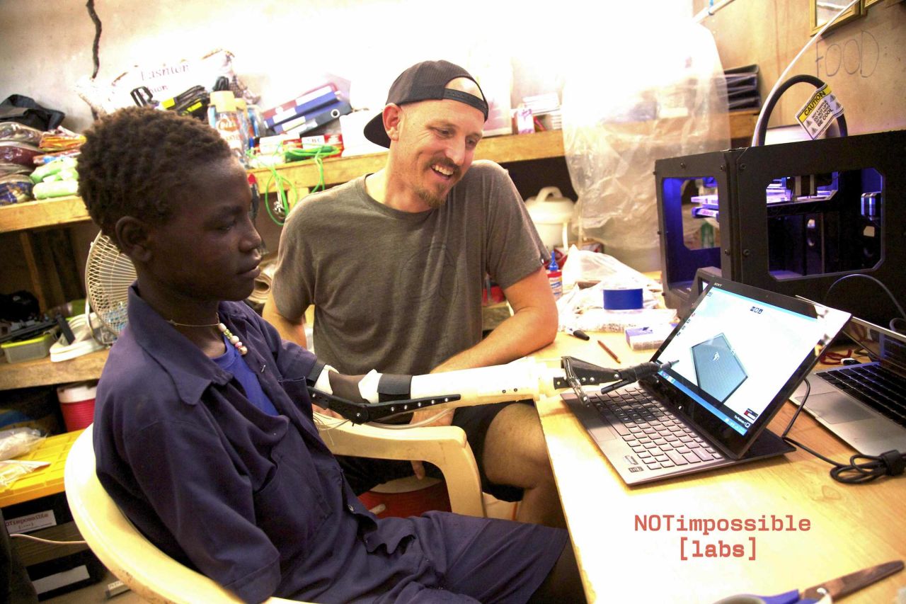 Ebeling traveled to Sudan in October 2013, and used a 3-D printer to fabricate a prosthetic arm for Daniel.