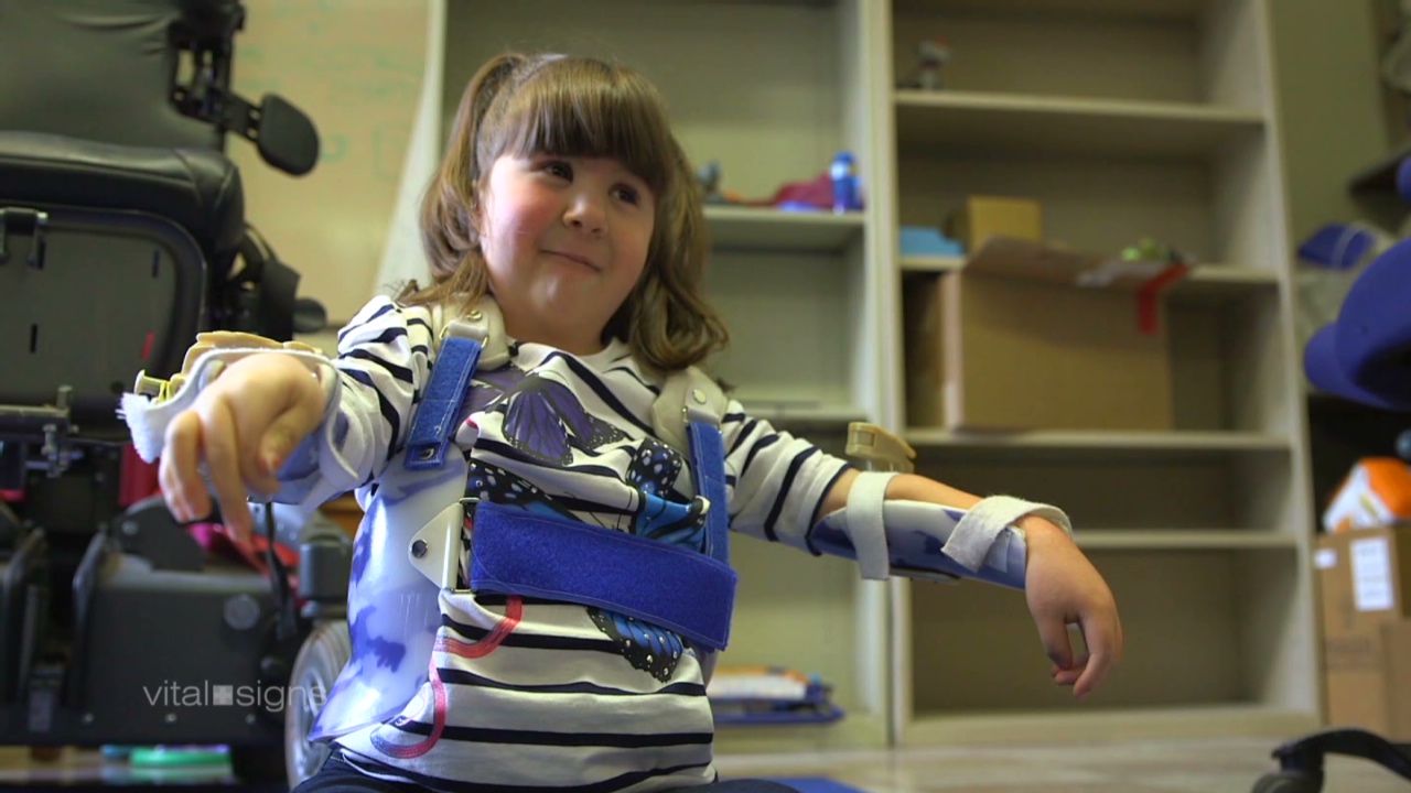 Robot exoskeleton lets her arms, reach for the stars CNN