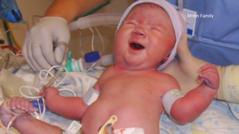 Hannah was born with a neuromuscular disease called arthrogryposis, which makes her joints curve and muscles extremely weak.
