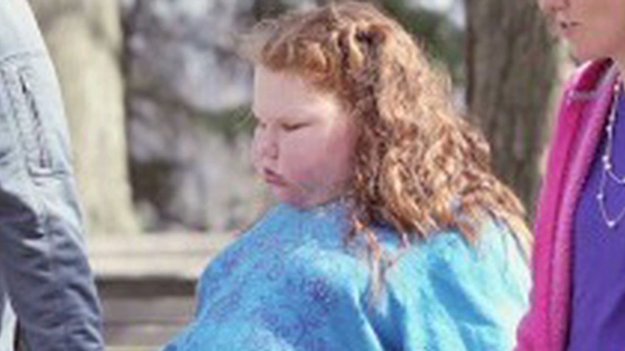 pkg 12 year old gastric bypass_00012414.jpg