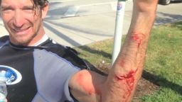 kite surfer attacked by shark _00003208.jpg