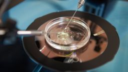 Laboratory Fertilization Of Eggs In IVF Treatment  Stock Photo:Image ID: 155727377 