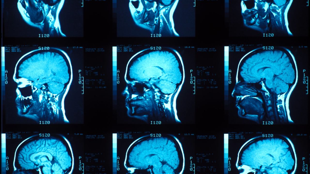 Scientists want to understand the variation in moral judgments among different people.