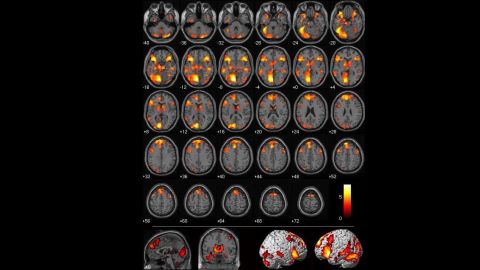 This image shows differences in brain activity between people who judge an act wrong and others who say it's not wrong.
