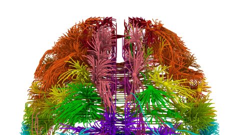 This is a 3-D view of connections in the brain originating from different cortical areas. 