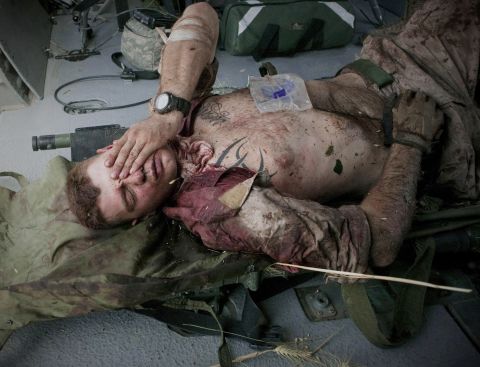 Cpl. Burness Britt, an injured U.S. Marine, reacts after being lifted onto a helicopter in June 2011.