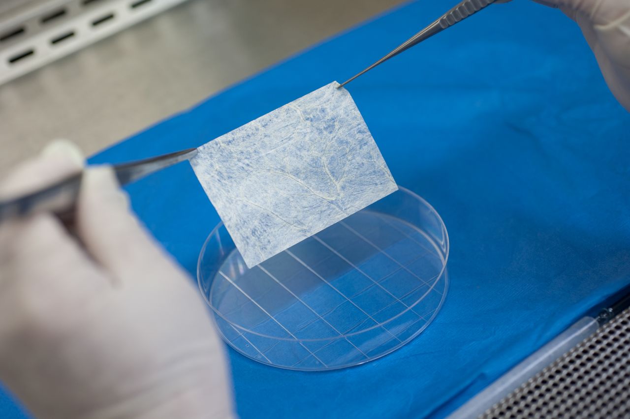 Dr. Yuanyuan Zhang, assistant professor at Wake Forest Institute for Regenerative Medicine, demonstrates the process used to engineer a vaginal organ. Zhang first selects a scaffold made of a biodegradable material.