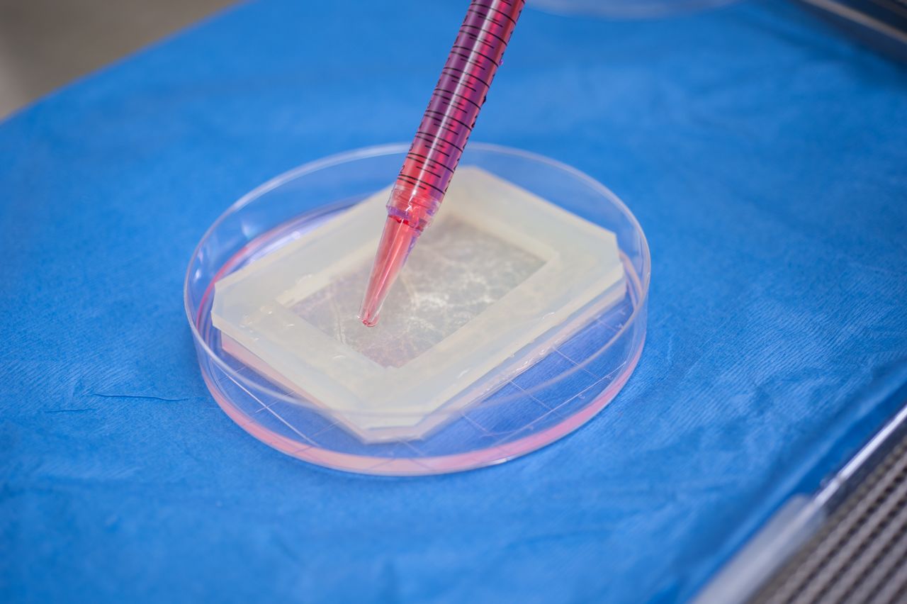 Once it is removed from the incubator, Zhang coats the other side of the scaffold with smooth muscle cells taken from the patient's biopsy.