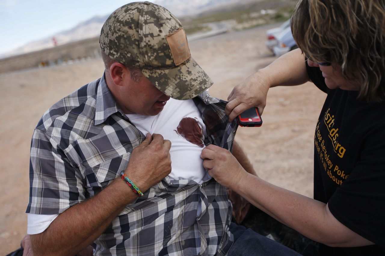 Thornton, right, looks at a wound on Bundy's son Ammon on April 9. Bundy family members and dozens of supporters angrily confronted a group of rangers holding Tasers and barking dogs on Wednesday. Bundy family members say they were thrown to the ground or jolted with a Taser. Federal officials say a police dog was kicked and officers were assaulted.