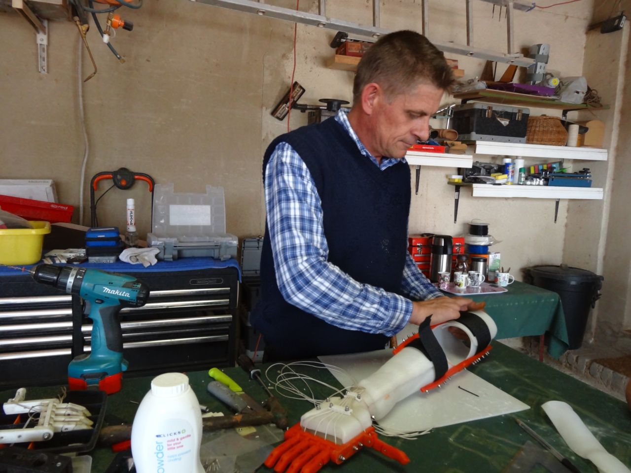 The company was started by Richard van As, who lost four fingers in a carpentry accident. His quest to replace his fingers led him to develop 3-D printed prosthetics.