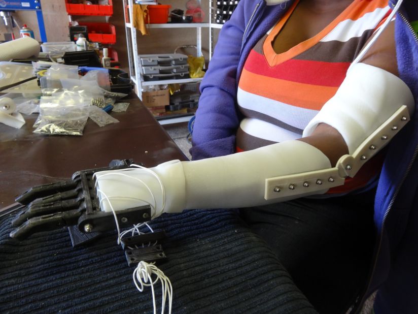 Body parts such as knuckles and joints are printed from the the thermoplastic material Polylactide (PLA), and are combined with stainless steel and aluminum to produce a personalized prosthetic. 