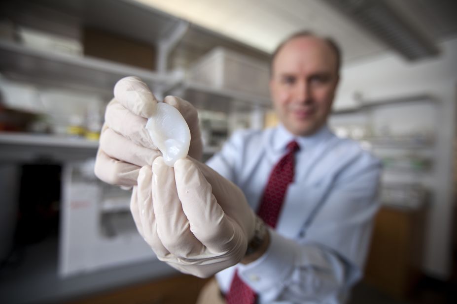 Lawrence Bonassar, of Cornell University, has created ears made from living cells, grown from 3-D printed molds.