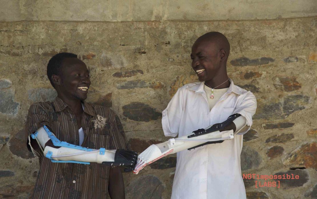 Daniel Omar and a friend compare prostheses