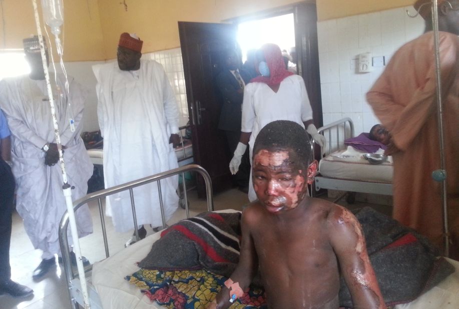 A man receives treatment at Konduga specialist hospital after a gruesome attack on January 26, 2014. It was suspected that Boko Haram militants opened fire on a village market and <a href="http://edition.cnn.com/2014/02/12/world/africa/nigeria-unrest/">torched homes in the village of Kawuri,</a> killing at least 45 people.