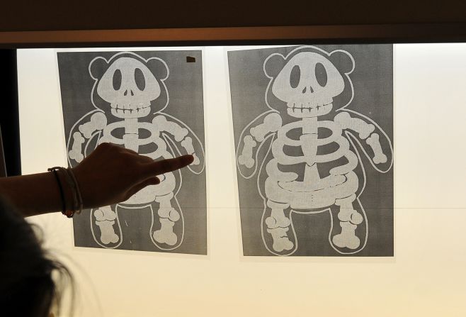 X-rays of "injured" teddy bears hang Monday, April 14, at a hospital in Dresden, Germany. The hospital hosted 1,000 Dresden preschoolers to help ease any fears they might have of doctors and hospitals. 