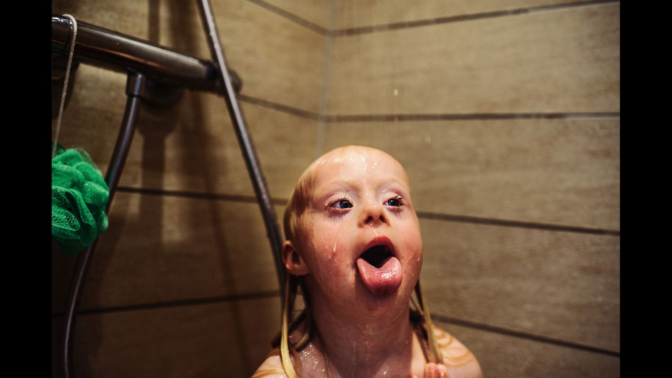 German photographer <a href="http://www.mariowezel.com/" target="_blank" target="_blank">Mario Wezel</a> earned first place in the People category for his photographs of a young girl living with Down syndrome in Denmark.